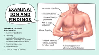 EXAMINAT
ION AND
FINDINGS
(ANTERIOR SHOULDER
DISLOCATION)
• Pain may be absent.
• Swelling
• Attitude of the shoulder-
shoulder abducted and external
rotation (anterior dislocation)
• Prominent acromion
• Loss of contour
• Loss of range of motion.
 