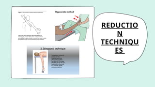REDUCTIO
N
TECHNIQU
ES
 