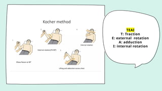 TEAI
T: Traction
E: external rotation
A: adduction
I: internal rotation
 