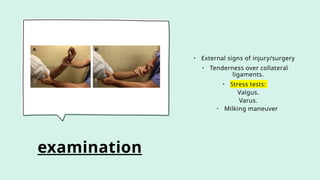 examination
• External signs of injury/surgery
• Tenderness over collateral
ligaments.
• Stress tests:
Valgus.
Varus.
• Milking maneuver
 