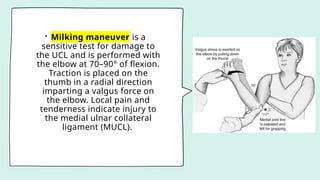 • Milking maneuver is a
sensitive test for damage to
the UCL and is performed with
the elbow at 70–90° of flexion.
Traction is placed on the
thumb in a radial direction
imparting a valgus force on
the elbow. Local pain and
tenderness indicate injury to
the medial ulnar collateral
ligament (MUCL).
 