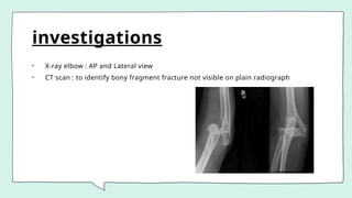 investigations
• X-ray elbow : AP and Lateral view
• CT scan : to identify bony fragment fracture not visible on plain radiograph
 