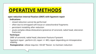 OPERATIVE METHODS
open reduction internal fixation (ORIF) with ligament repair
Indications
• closed reduction cannot be performed
• often due to entrapped soft tissue or osteochondral fragments
• persistent instability after reduction
• acute complex elbow dislocations (presence of coronoid, radial head, olecranon
fractures)
Technique
ORIF of coronoid, radial head, olecranon fracture if present
ligament repair : perform LCL repair +/- MCL repair depending on intraoperative
stability
Postoperative : elbow requires >50-60° flexion to maintain reduction
 