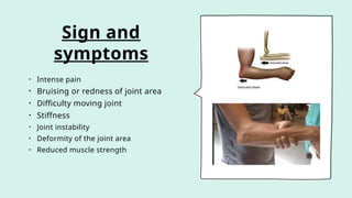 Sign and
symptoms
• Intense pain
• Bruising or redness of joint area
• Difficulty moving joint
• Stiffness
• Joint instability
• Deformity of the joint area
• Reduced muscle strength
 