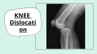 KNEE
Dislocati
on
 