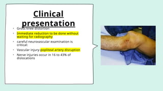 Clinical
presentation
• Gross knee distortion
• Immediate reduction to be done without
waiting for radiography
• careful neurovascular examination is
critical:
• Vascular injury-popliteal artery disruption
• Nerve injuries occur in 16 to 43% of
dislocations
 