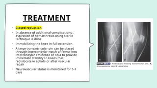 TREATMENT
• Closed reduction
• In absence of additional complications ,
aspiration of hemarthrosis using sterile
technique is done
• Immobilizing the knee in full extension
• A large transartricular pin can be placed
through intercondylar notch of femur into
intercondylar eminence of tibia to provide
immediate stability to knees that
redislocate in splints or after vascular
repair
• Neurovascular status is monitored for 5-7
days
 