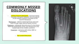 COMMONLY MISSED
DISLOCATIONS
• Lisfranc fracture dislocation :characterized by
traumatic disruption between the articulation
of the medial cuneiform and base of the
second metatarsal.
Mechanism : indirect rotational forces and axial
load through hyper-plantarflexed forefoot
Diagnosis : radiograph discontinuity of a line drawn
from the medial base of the 2nd metatarsal to the
medial side of the middle cuneiform
Treatment : operative with either ORIF or
arthrodesis.
• Peri lunate dislocation :
 