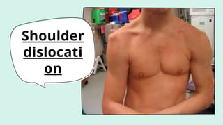 Shoulder
dislocati
on
 