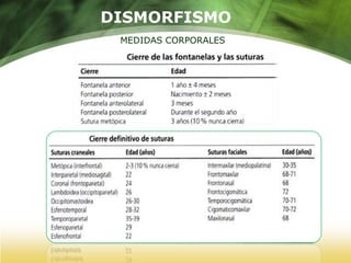 DISMORFISMOMEDIDAS CORPORALES