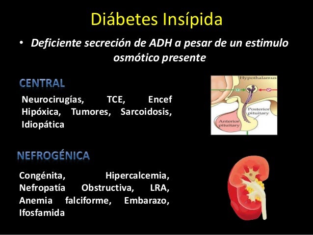Disnatremias Disnatremias