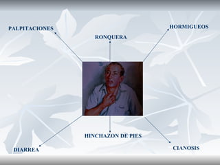 PALPITACIONES RONQUERA HORMIGUEOS HINCHAZON DE PIES  CIANOSIS DIARREA 