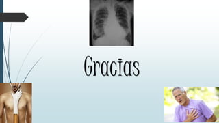 Gracias
 