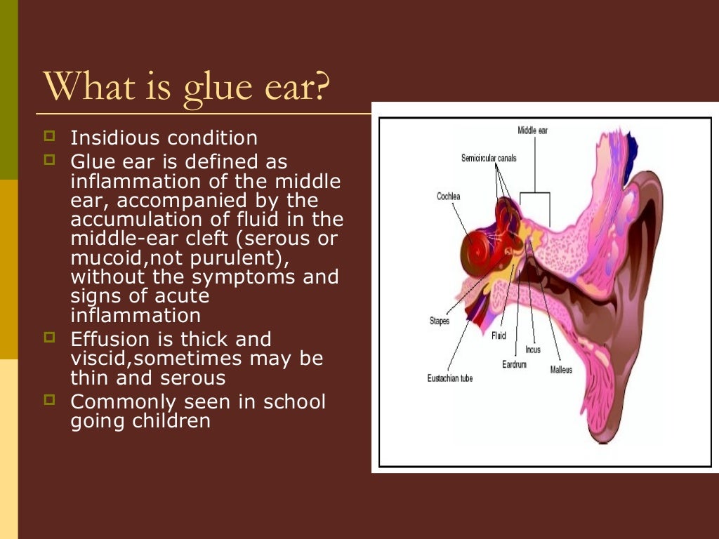 Disease of middle ear,dr.s.s.bakshi,27.03.17