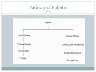 Pathway of Pulpitis
 