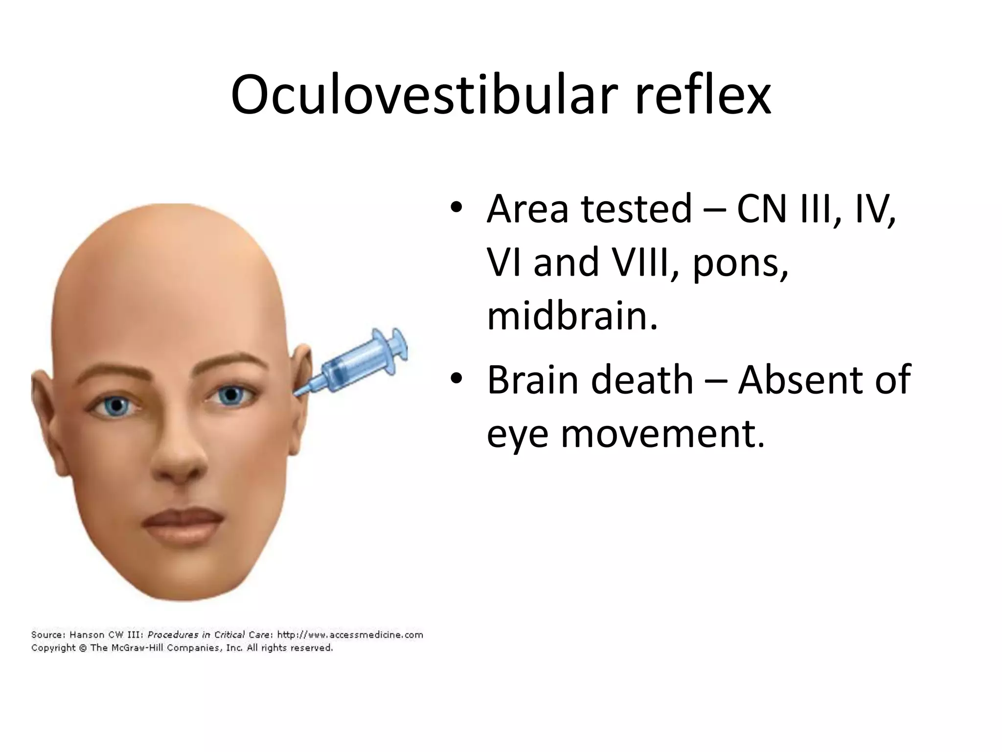 Oculovestibular reflex
• Area tested – CN III, IV,
VI and VIII, pons,
midbrain.
• Brain death – Absent of
eye movement.
 
