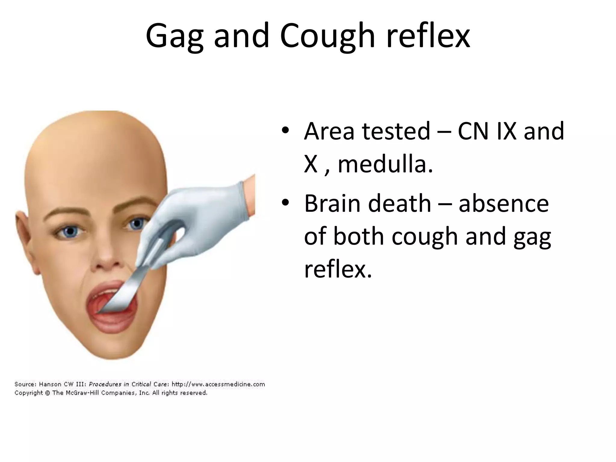 Gag and Cough reflex
• Area tested – CN IX and
X , medulla.
• Brain death – absence
of both cough and gag
reflex.
 