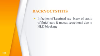 DACRYOCYSTITIS
▸ Infection of Lacrimal sac- b,coz of stasis
of fluid(tears & mucus secretions) due to
NLD blockage
112
 