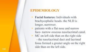 EPIDEMIOLOGY
▸ Facial features: Individuals with
brachycephalic heads- the NLD is
longer, narrower.
▸ patients with a flat nose and narrow
face- narrow osseous nasolacrimal canal.
▸ MC on left side than on the right side
- the nasolacrimal duct and lacrimal
fossa formed a greater angle on the right
side than on the left side.
115
 