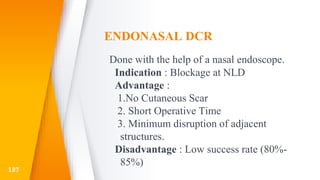 ENDONASAL DCR
Done with the help of a nasal endoscope.
Indication : Blockage at NLD
Advantage :
1.No Cutaneous Scar
2. Short Operative Time
3. Minimum disruption of adjacent
structures.
Disadvantage : Low success rate (80%-
85%)
137
 