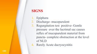 SIGNS
1. Epiphora
2. Discharge- mucopurulent
3. Regurgitation test positive- Gentle
pressure over the lacrimal sac causes
reflex of mucopurulent material from
puncta- complete obstruction at the level
of NLD
4. Rarely Acute dacryocystitis
150
 
