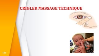CRIGLER MASSAGE TECHNIQUE
153
 