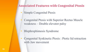 Associated Features with Congenital Ptosis
▸ Simple Congenital Ptosis
▸ Congenital Ptosis with Superior Rectus Muscle
weakness – Double elevator palsy
▸ Blephrophimosis Syndrome
▸ Congenital Synkinetic Ptosis : Ptotic lid retraction
with Jaw movement
16
 
