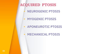 ACQUIRED PTOSIS
▸ NEUROGENIC PTOSIS
▸ MYOGENIC PTOSIS
▸ APONEUROTIC PTOSIS
▸ MECHANICAL PTOSIS
18
 