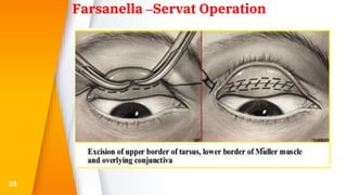 35
Farsanella –Servat Operation
 