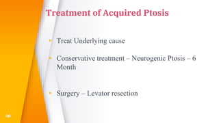 Treatment of Acquired Ptosis
▸ Treat Underlying cause
▸ Conservative treatment – Neurogenic Ptosis – 6
Month
▸ Surgery – Levator resection
40
 