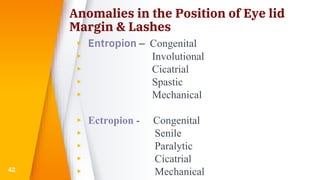 Anomalies in the Position of Eye lid
Margin & Lashes
▸ Entropion – Congenital
▸ Involutional
▸ Cicatrial
▸ Spastic
▸ Mechanical
▸ Ectropion - Congenital
▸ Senile
▸ Paralytic
▸ Cicatrial
▸ Mechanical42
 