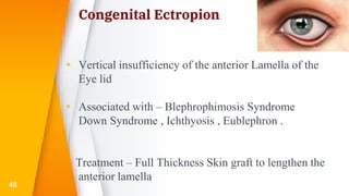 Congenital Ectropion
▸ Vertical insufficiency of the anterior Lamella of the
Eye lid
▸ Associated with – Blephrophimosis Syndrome
Down Syndrome , Ichthyosis , Eublephron .
Treatment – Full Thickness Skin graft to lengthen the
anterior lamella
45
 