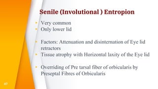 Senile (Involutional ) Entropion
▸ Very common
▸ Only lower lid
▸ Factors: Attenuation and disinternation of Eye lid
retractors
▸ Tissue atrophy with Horizontal laxity of the Eye lid
▸ Overriding of Pre tarsal fiber of orbicularis by
Preseptal Fibres of Orbicularis
47
 