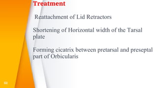 Treatment
Reattachment of Lid Retractors
Shortening of Horizontal width of the Tarsal
plate
Forming cicatrix between pretarsal and preseptal
part of Orbicularis
52
 