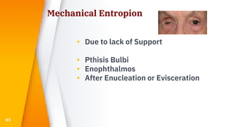 Mechanical Entropion
▸ Due to lack of Support
▸ Pthisis Bulbi
▸ Enophthalmos
▸ After Enucleation or Evisceration
61
 