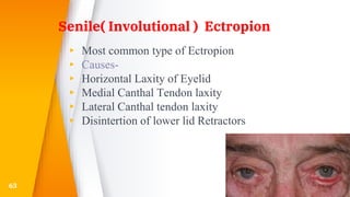 Senile( Involutional ) Ectropion
▸ Most common type of Ectropion
▸ Causes-
▸ Horizontal Laxity of Eyelid
▸ Medial Canthal Tendon laxity
▸ Lateral Canthal tendon laxity
▸ Disintertion of lower lid Retractors
63
 