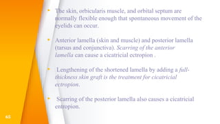 ▸ The skin, orbicularis muscle, and orbital septum are
normally flexible enough that spontaneous movement of the
eyelids can occur.
▸ Anterior lamella (skin and muscle) and posterior lamella
(tarsus and conjunctiva). Scarring of the anterior
lamella can cause a cicatricial ectropion .
▸ Lengthening of the shortened lamella by adding a full-
thickness skin graft is the treatment for cicatricial
ectropion.
▸ Scarring of the posterior lamella also causes a cicatricial
entropion.
65
 