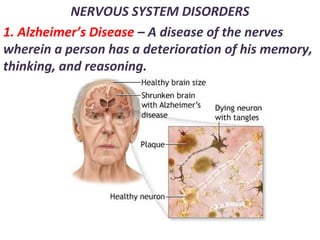 NERVOUS SYSTEM DISORDERS
1. Alzheimer’s Disease – A disease of the nerves
wherein a person has a deterioration of his memory,
thinking, and reasoning.
 