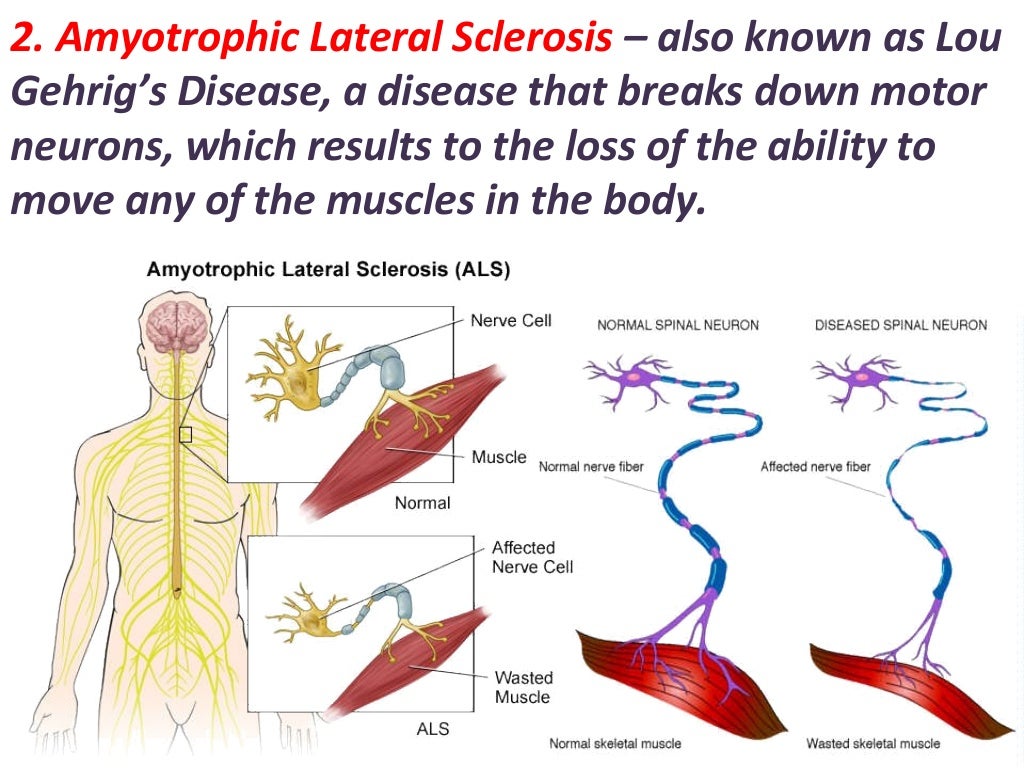disorder-of-the-nervous-system