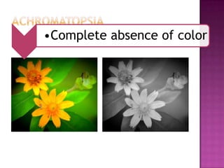 •Complete absence of color
 