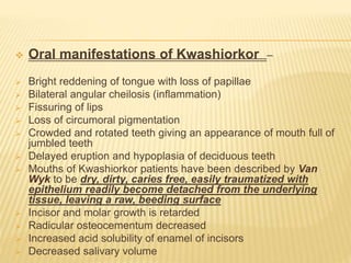  Oral manifestations of Kwashiorkor –
 Bright reddening of tongue with loss of papillae
 Bilateral angular cheilosis (inflammation)
 Fissuring of lips
 Loss of circumoral pigmentation
 Crowded and rotated teeth giving an appearance of mouth full of
jumbled teeth
 Delayed eruption and hypoplasia of deciduous teeth
 Mouths of Kwashiorkor patients have been described by Van
Wyk to be dry, dirty, caries free, easily traumatized with
epithelium readily become detached from the underlying
tissue, leaving a raw, beeding surface
 Incisor and molar growth is retarded
 Radicular osteocementum decreased
 Increased acid solubility of enamel of incisors
 Decreased salivary volume
 