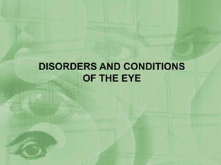 DISORDERS AND CONDITIONS
OF THE EYE

 