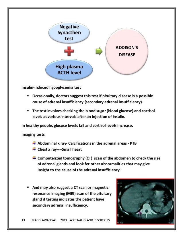 disorders of adrenal gland disorders of adrenal gland