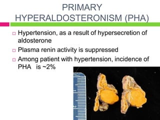 disorders of adrenal gland byaina.pptx