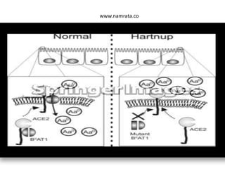 Disorders of amino acid metabolism | PPTX