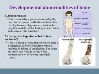 Disorders of Bones and Joints Pharm d.pptx