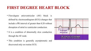 Disorders of Conduction of Heart- Interpretation and Management | PPTX