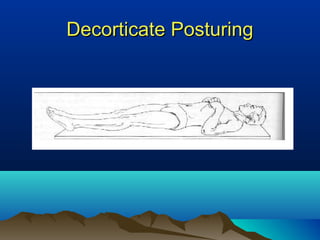 Disorders of consciousness | PPT