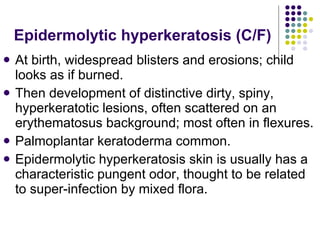 Epidermolytic hyperkeratosis (C/F) <ul><li>At birth, widespread blisters and erosions; child looks as if burned. </li></ul...