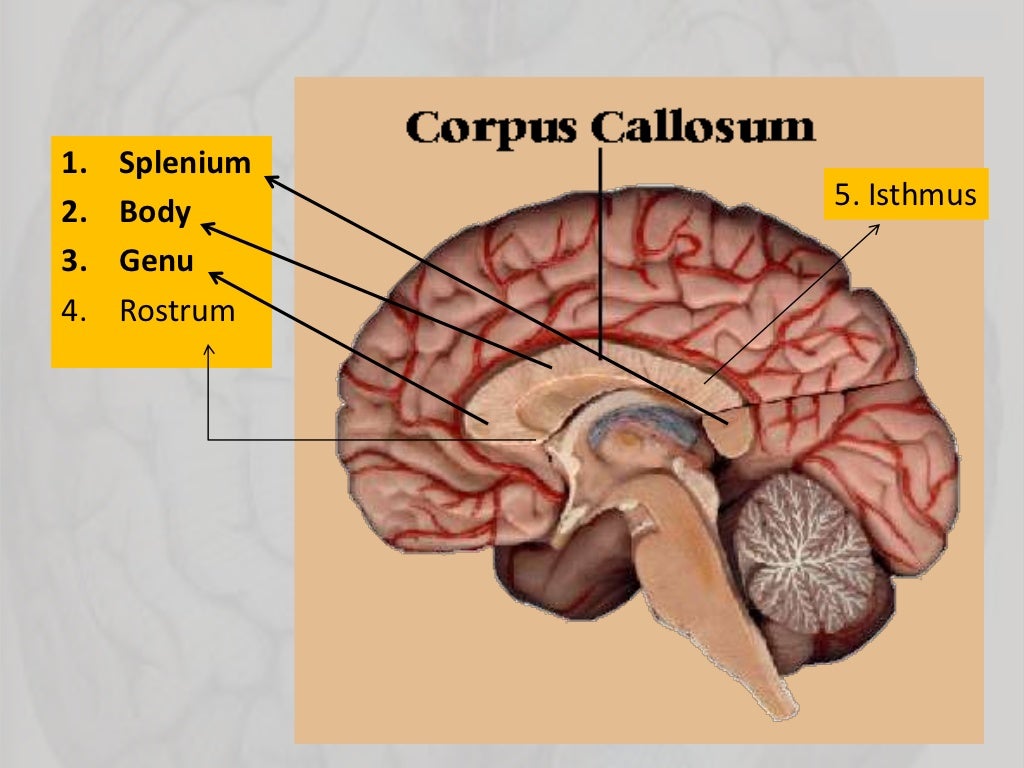 Commissura cerebri anterior анатомия. Lamina arcus vertebrae латынь. Цистерна латеральной ямки. Corpus callosum. Ventriculus tertius анатомия.